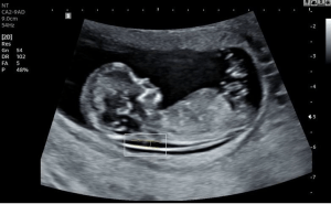 2D Ultrasounds