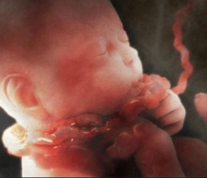 Problems with the umbilical cord