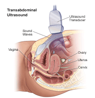Routine Pelvic scan 1