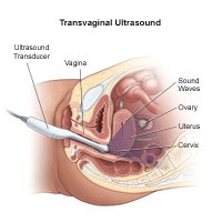 Routine Pelvic scan 2