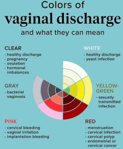 color of vaginal discharges